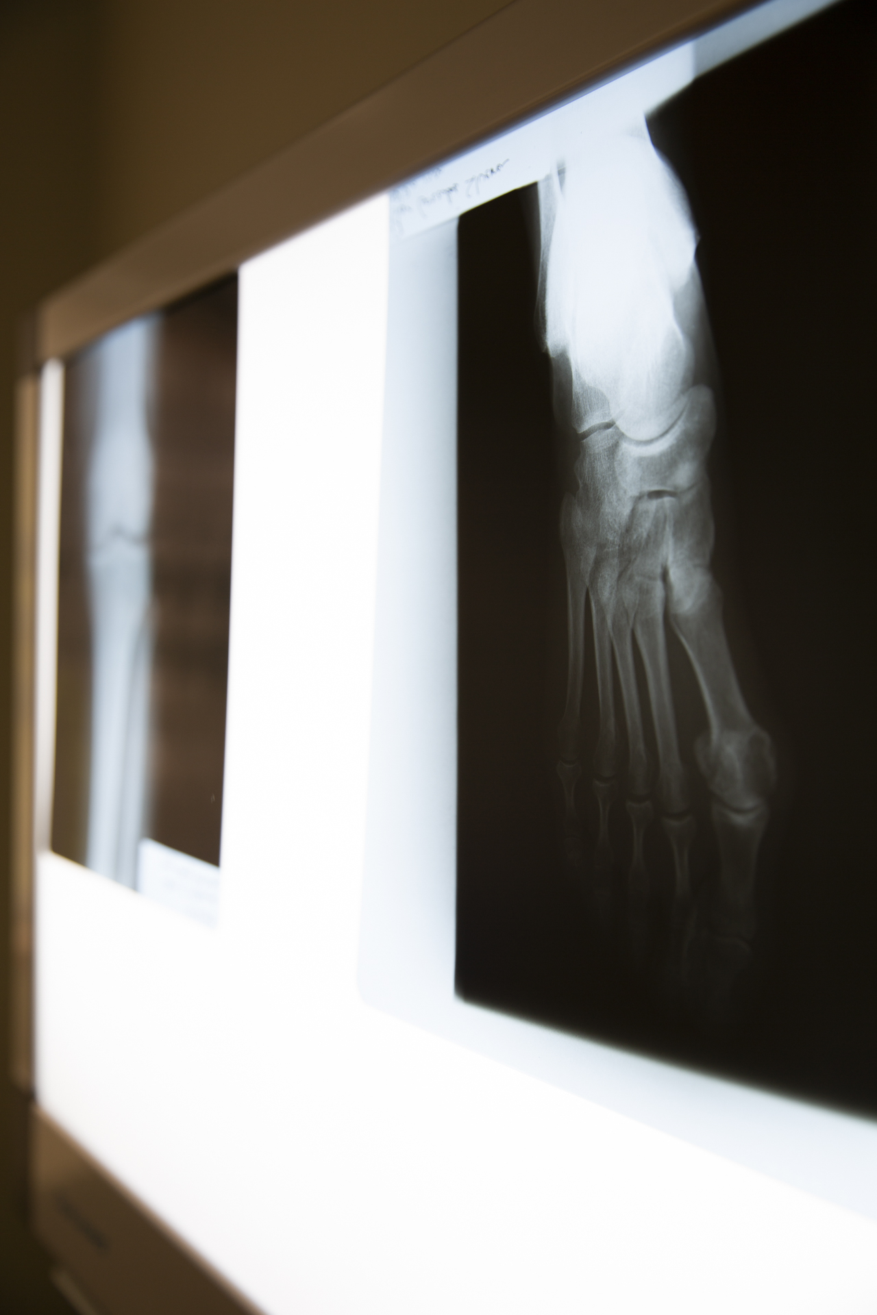 Detalle de radiografía en una consulta médica